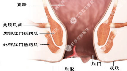 泉州肛肠