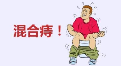 泉州混合痔怎样治效果果较佳
