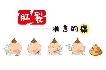 你知道肛裂的症状有哪些 患了肛裂该注意什么呢