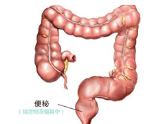 大便困难吃什么较好